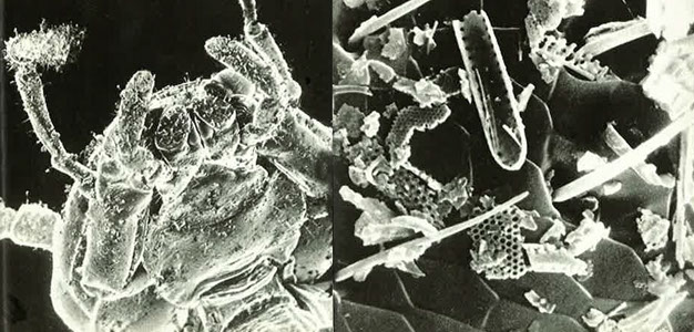 diatomaceous earth under microscope flea