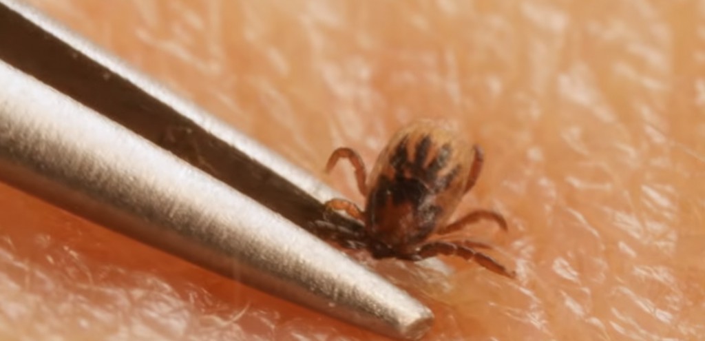 ticks can cause lime disease and rocky mountain fever